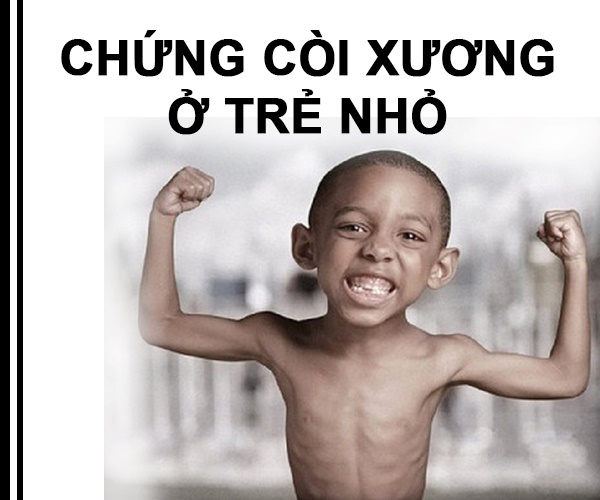 Chong-coi-xuong-o-tre